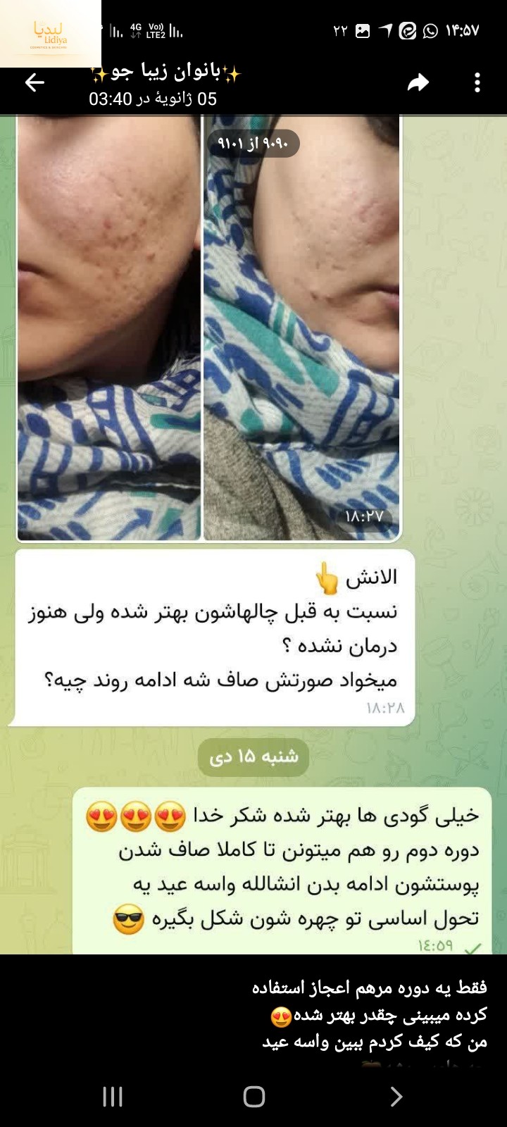 ✅مرهم اعجاز  🌈حاوی خاویار حلزون🐌 🌈🌈کشته مروارید🐚 🌈🌈🌈ژل حلزون🐌 بیش از 5 مدل روغن مرکب که هــر  کدوم ازین روغن ها ترکیــب 8روغن  گیاهیه با کارایــی فوق العاده ترکیــب  40روغن 😎  ♡مرهم اعجاز ب...